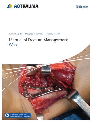 cover image of Manual of Fracture Management--Wrist